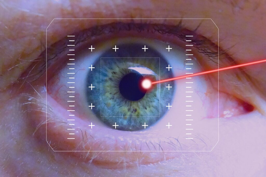 opération au laser Lasik_Image